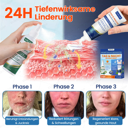 KUBOZN® Psoriasis Tag & Nacht System – 100% steroidfrei gegen Schuppen & Plaque (offer)