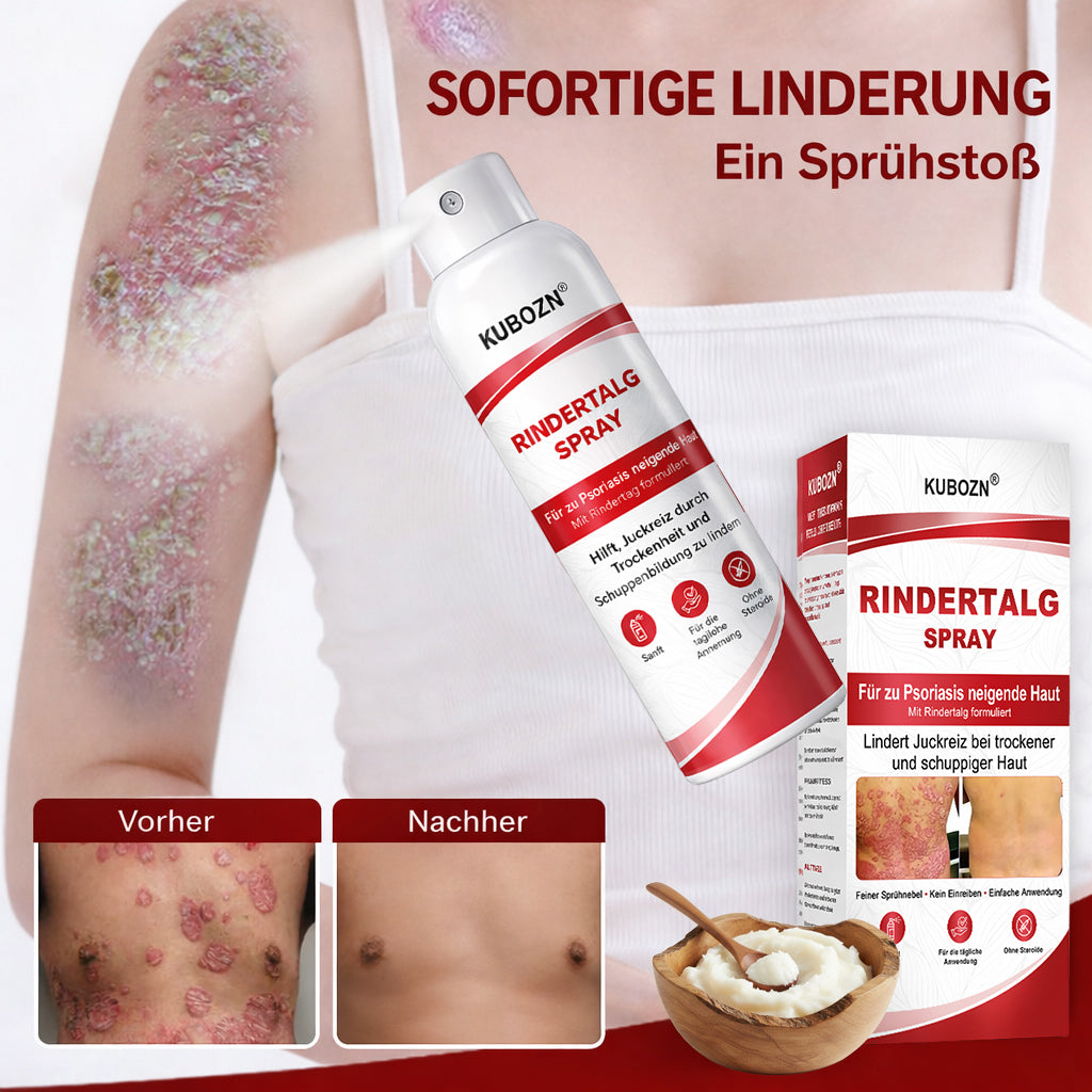 KUBOZN® Rindertalgspray für juckende, schuppige Psoriasis-Haut
