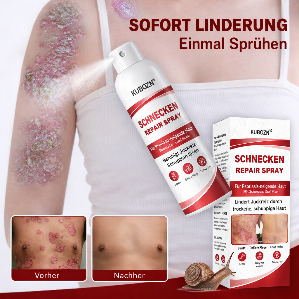 KUBOZN® Schnecken-Reparaturspray für juckende, schuppige Psoriasis-Haut 1