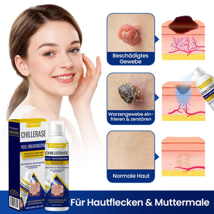 Cvreoz® ChillErase Pickel-Erneuerungsspray