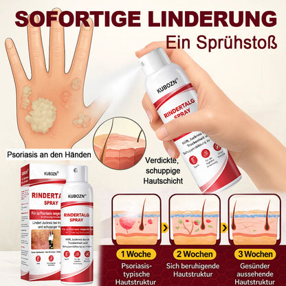 KUBOZN® Rindertalg-Spray für juckende, schuppige Psoriasis-Haut 1