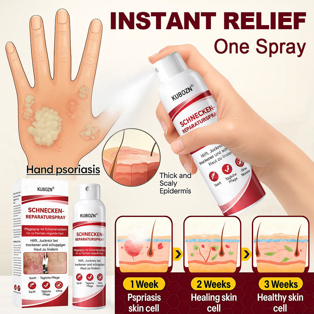 KUBOZN® Schneckenspray zur Behandlung von juckender, schuppiger Psoriasis-Haut