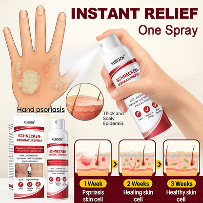 KUBOZN® Schneckenspray zur Behandlung von juckender, schuppiger Psoriasis-Haut