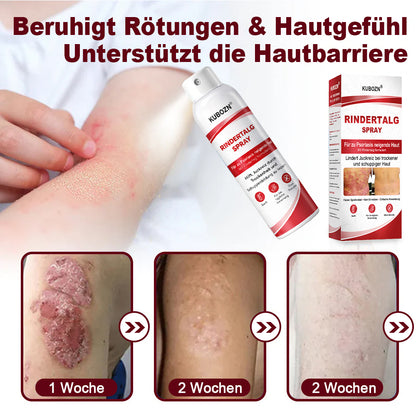 KUBOZN® Rindertalgspray für juckende, schuppige Psoriasis-Haut