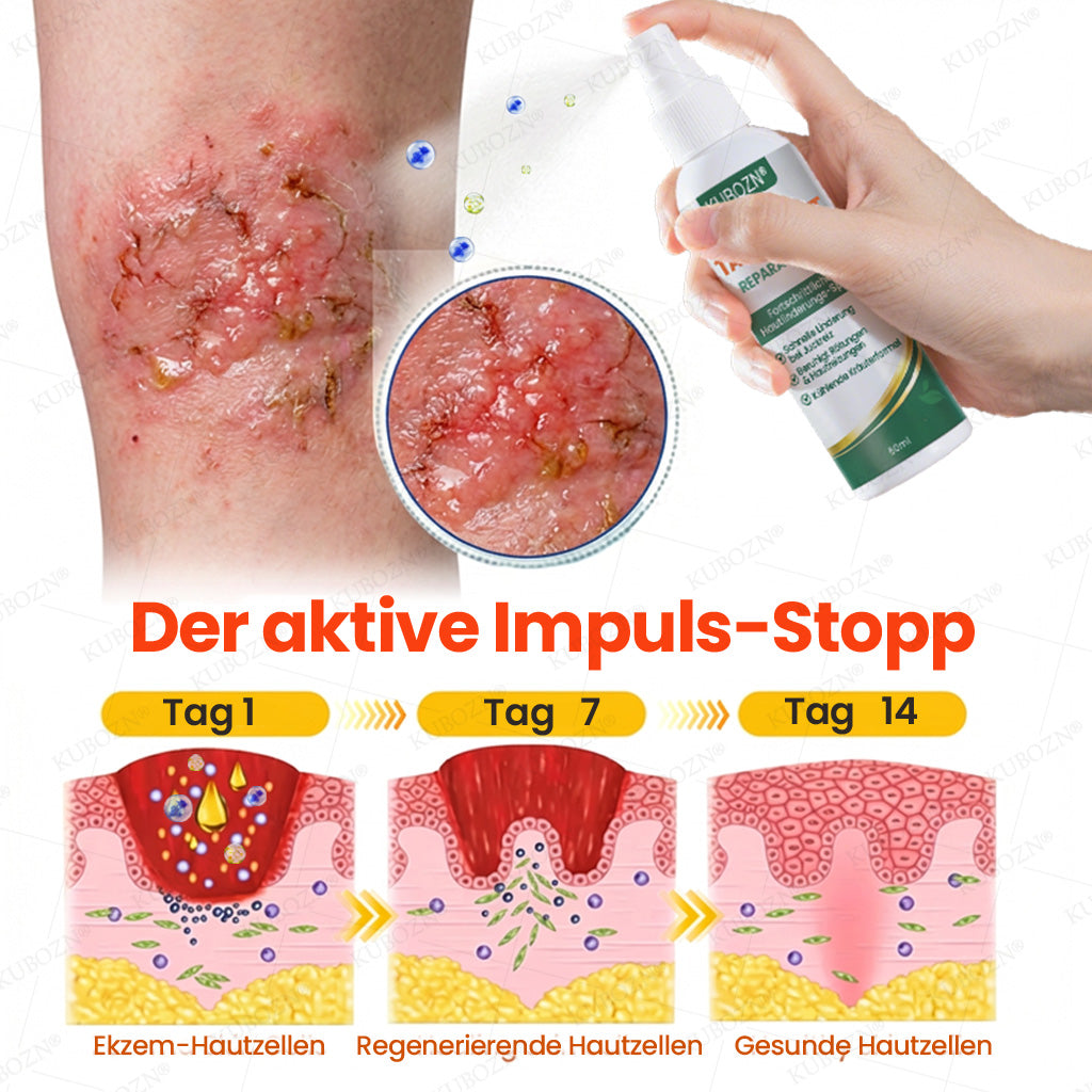 KUBOZN® Eczem & Neurodermitis Set – 24h Pflege bei Juckreiz, Rötungen & geschädigter Haut (offer)