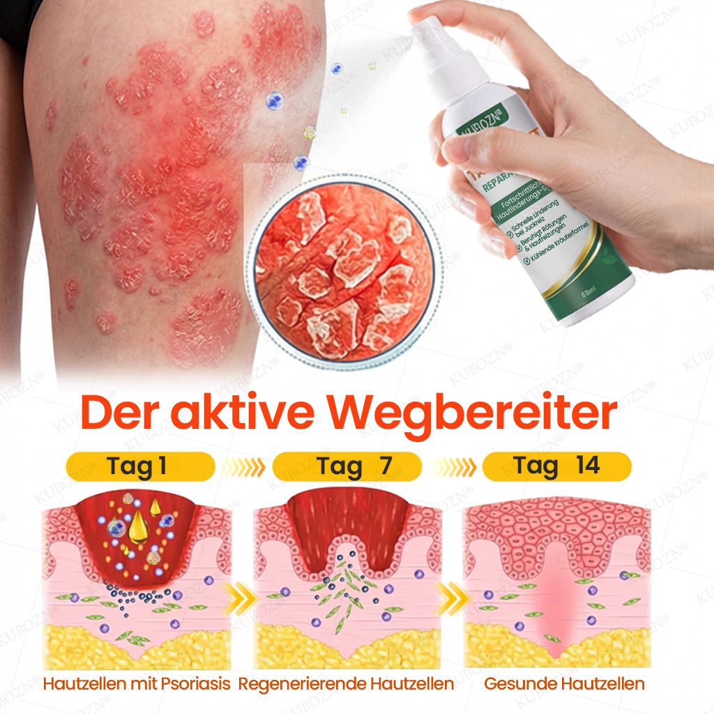 KUBOZN® Psoriasis Tag & Nacht System – 100% steroidfrei gegen Schuppen & Plaque (offer)