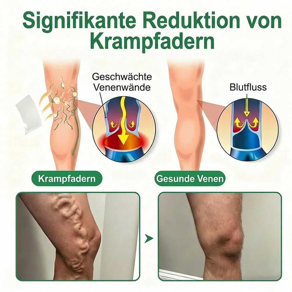 Healrize® VeinEase Mikronadel-Technologie⚡Spürbare Wirkung in Tagen – nachhaltige Verbesserung