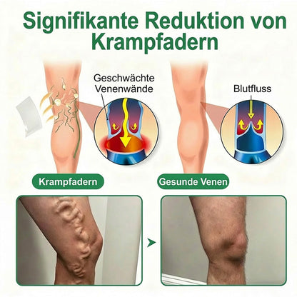 Healrize® VeinEase Mikronadel-Technologie⚡Spürbare Wirkung in Tagen – nachhaltige Verbesserung