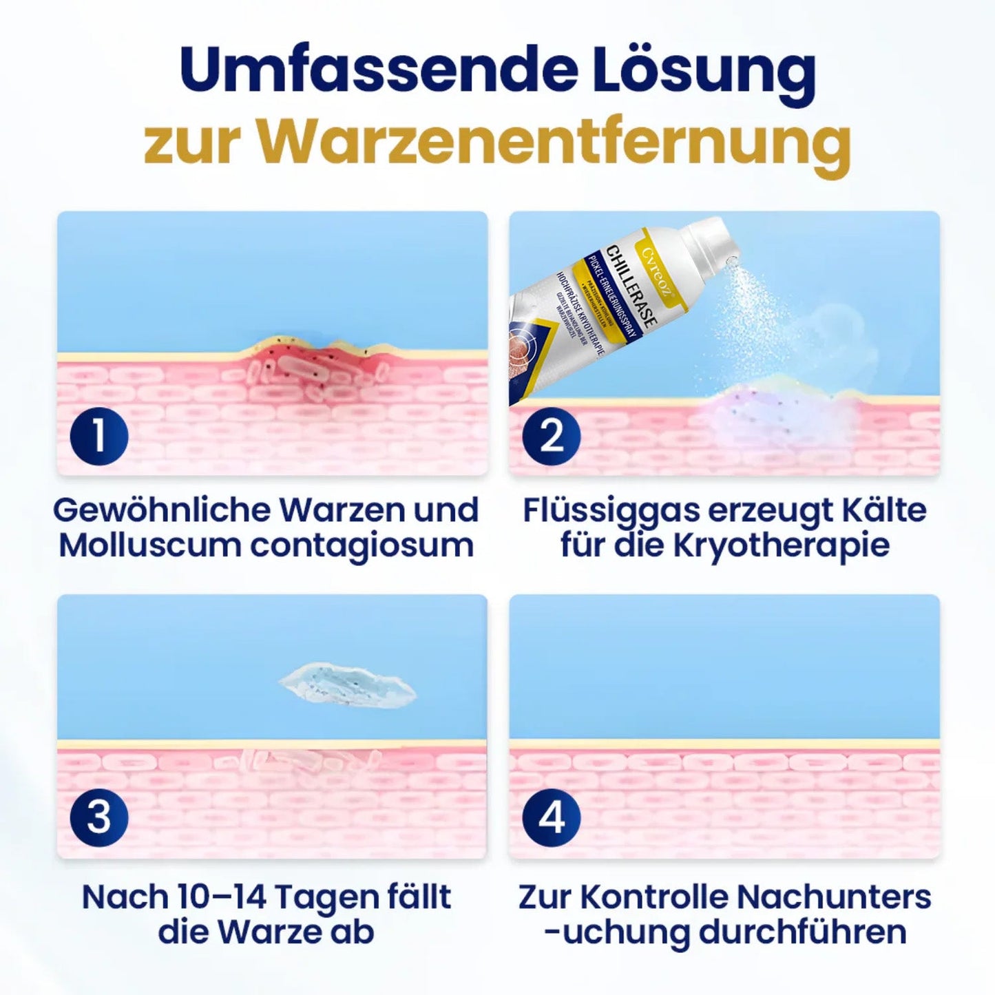 Cvreoz® ChillErase Pickel-Erneuerungsspray