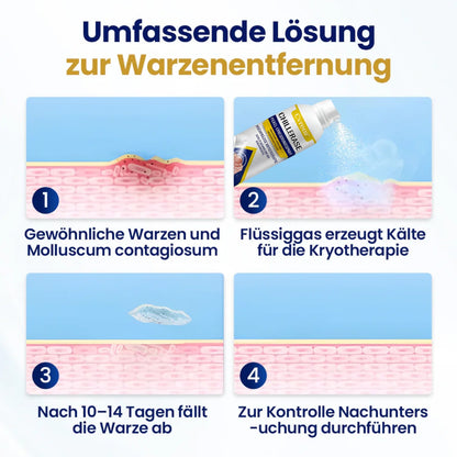 Cvreoz® ChillErase Pickel-Erneuerungsspray