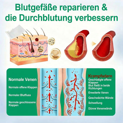 Healrize® VeinEase Mikronadel-Technologie⚡Spürbare Wirkung in Tagen – nachhaltige Verbesserung