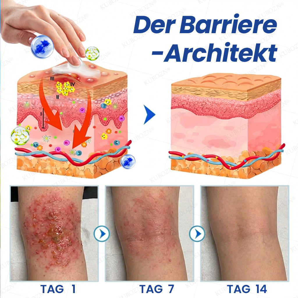 KUBOZN® Eczem & Neurodermitis Set – 24h Pflege bei Juckreiz, Rötungen & geschädigter Haut (offer)