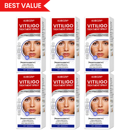 KUBOZN® Vitiligo-Behandlungsspray – Sichtbare Ergebnisse in wenigen Wochen, 100 % natürlich und steroidfrei