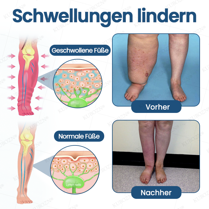 ❄️ KUBOZN® Ice-Cool Multi-Ball Roll-On – Schwellungen weg in Minuten, spürbar leichte Beine
