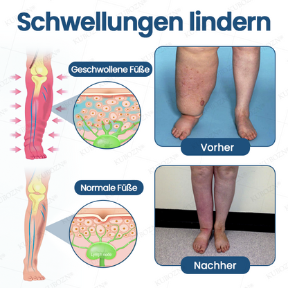 ❄️ KUBOZN® Ice-Cool Multi-Ball Roll-On – Schwellungen weg in Minuten, spürbar leichte Beine