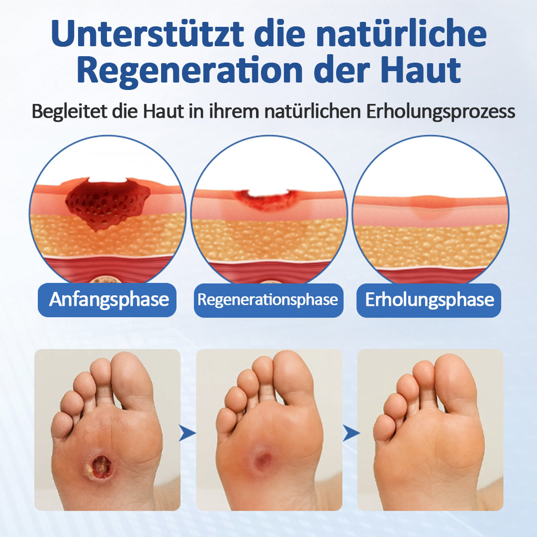 Healrize® GlucoDerm Barriere-Spray Offer)