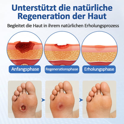 Healrize® GlucoDerm Barriere-Spray Offer)