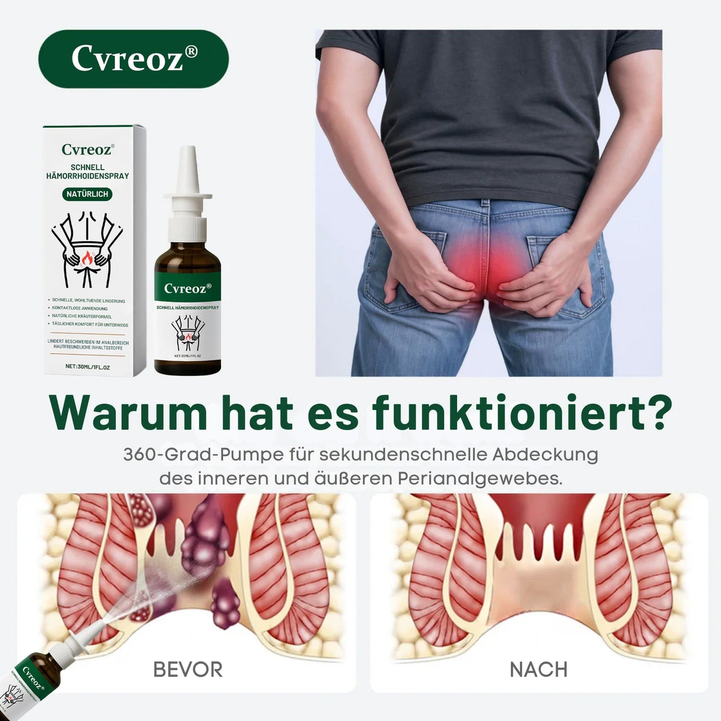 Cvreoz® Schnell Hämorrhoidenspray
