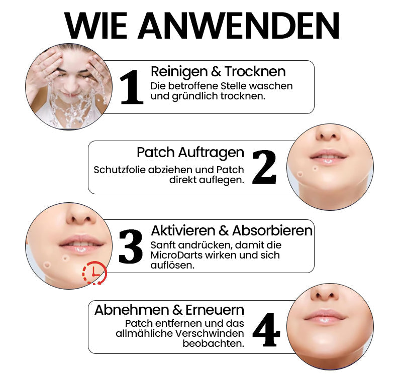 KUBOZN® Pro MicroDarts TAG'Gone Hautpflaster zur Skin-Tag-Entfernung  🅱︎