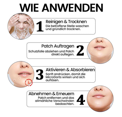 KUBOZN® Pro MicroDarts TAG'Gone Hautpflaster zur Skin-Tag-Entfernung  🅱︎