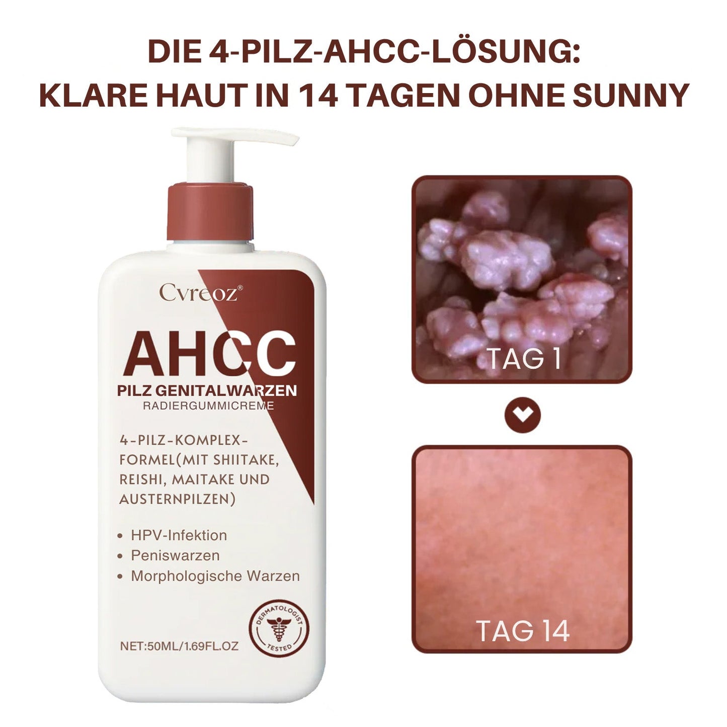 Cvreoz®AHCC-Pilz Genitalwarzen Radiergummicreme