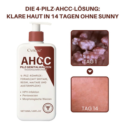 Cvreoz®AHCC-Pilz Genitalwarzen Radiergummicreme